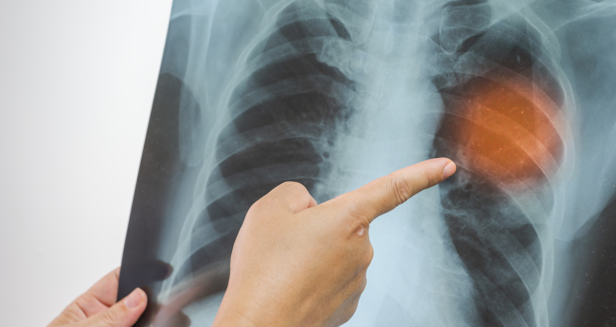 hemen hastaneye gitmenizi gerektiren zaturre belirtileri cogu kisi farkinda bile degil eZsl51ta.jpg